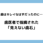 歯はキレイなはずだったのに…歯医者で指摘された「見えない歯石」